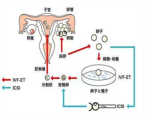生命奇迹的播种：供卵试管代孕点亮希望之旅